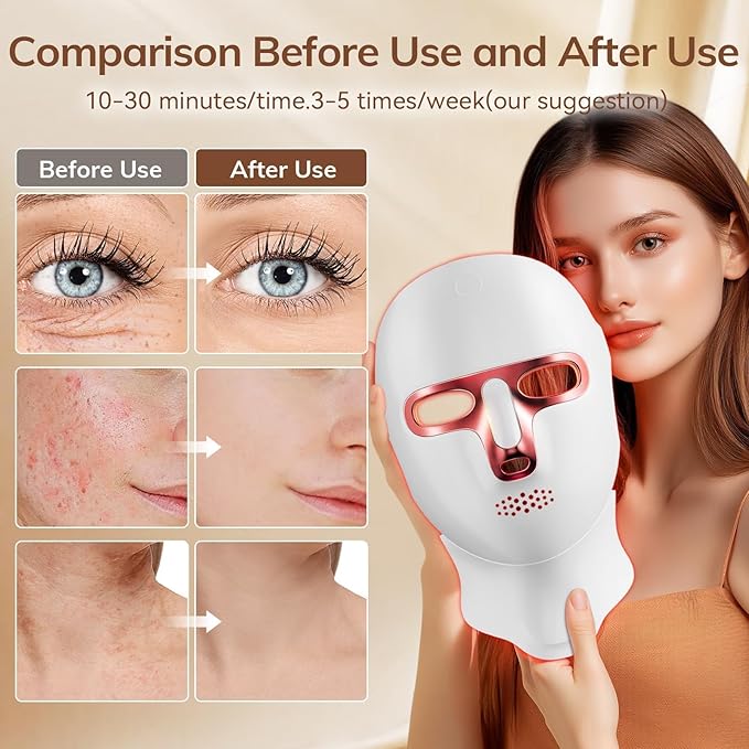 ONLUKY Red Light Therapy Mask for Face,Cordless LED Face Mask Light Therapy,USB C Rechargeable,Infrared Lights Masks for Home Working Travel Yoga Sleep