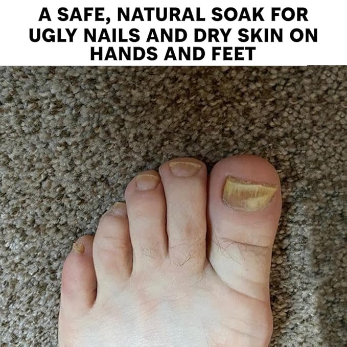 Long Creek Herbs Nail Soak - 100 Percent Natural Hand and Foot Soak - Strengthens Nails and Softens Skin - Relieves Dryness and Cracked Heels