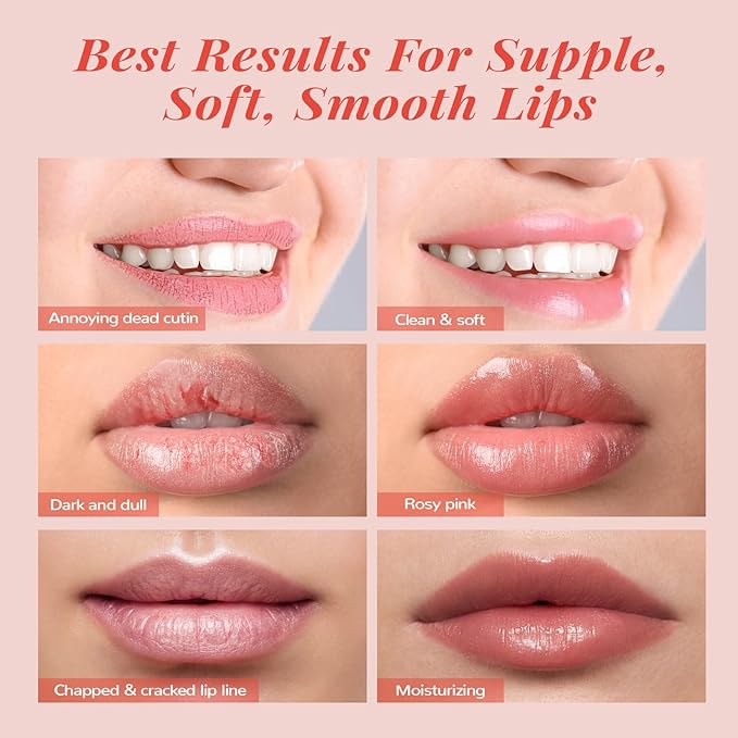 Hydrating Lip Mask Set, Lip Scrub & Lip Butter, Overnight Lip Treatment Set Enriched With Ceramide, Watermelon and Shea Butter, For A Softer & Smoother Lips, Overnight Lip Mask Mothers Day Gifts