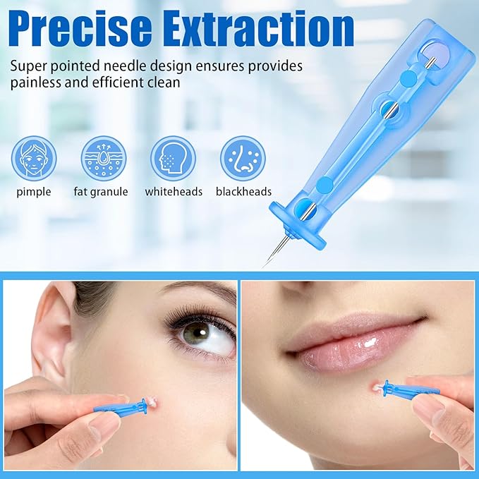 200Pcs Sterile Needles for Pimples, Disposable Acne Needle Effective Blemish and Blackhead Removal Tools for Clear Skin