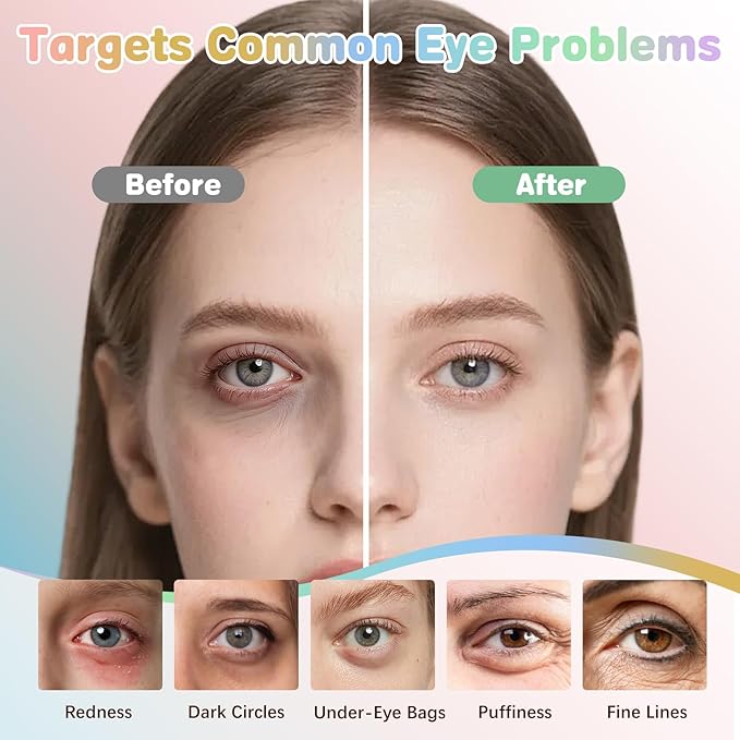 120 Pairs Under Eye Patches for Puffy Eyes and Dark Circles - Eye Mask Patches Variety Pack Travel & Skincare Gifts for Women/Men (Hyaluronic, 24K Gold, Grape, Caffeine, Aloe)