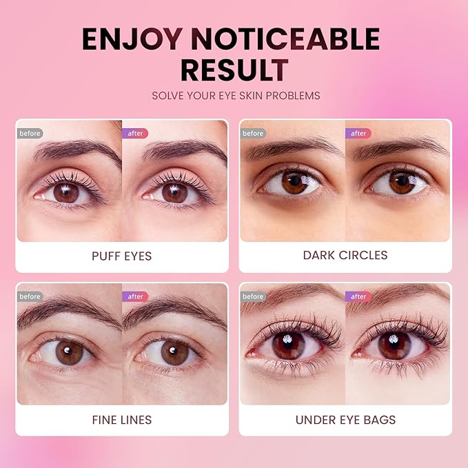 AILEORY Under Eye Patches (48 Pairs) - Tri-color Glitter Eye Gel Pads for Dark Circles, Puffy Eyes, Under eye Bags, Wrinkles | Natural Collagen Under Eye Mask Patches, Mothers Day Gifts for Mom