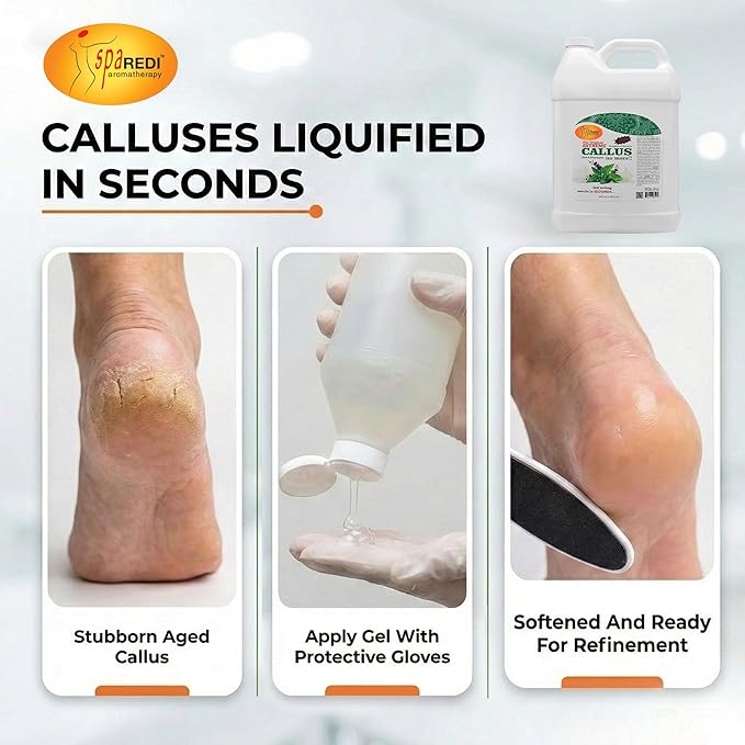 SPA REDI - Callus Remover for Feet Gel, Mint and Eucalyptus, 128 Oz - Professional Pedicure Foot Care - Removes Toughest Calluses in Seconds and Smooths Dry Cracked Heels