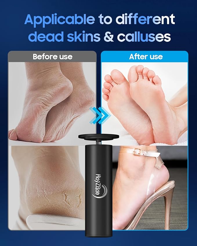 FSA&HSA Electronic Foot File,Callus Remover for Foot - Dead Skin Removal,Foot Scrubber with 60 Pcs Sandpaper Discs- Effortless Soft Smooth Skin in Minutes,for Women & Men