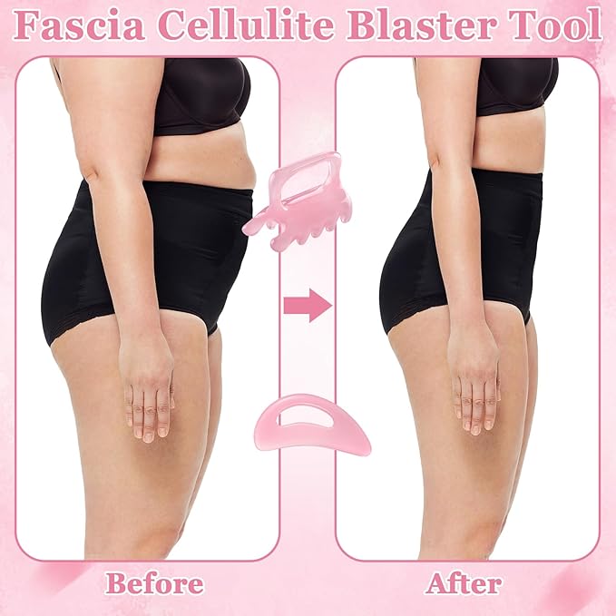 ProSuites 2Pack Fascia Massage Tool,Fascia Blaster for Cellulite Release Pink Resin Body Gua Sha Tool for Waist,Back,Legs,Face