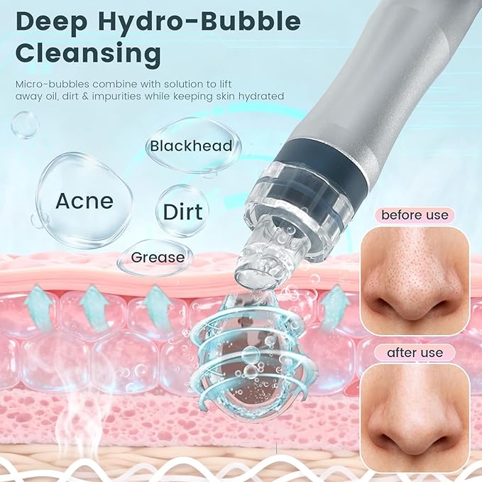 Hydrogen Oxygen Facial Machine, Hydro Facial Machine & Hydrodermabrasion Machine for Skin Care, Facial Vacuum Pore Cleaner, Hydro Dermabrasion Machine for Deep Cleansing & Hydration, Home Use