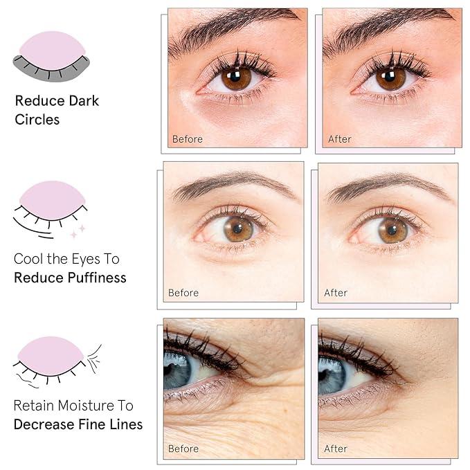 grace & stella Under Eye Mask Variety Pack - 18 Pairs of Under Eye Patches for Dark Circles - With 6 Colors (3 Pairs/Color) - Mothers Day Gifts for Mom - Gel Masks Puffy Eyes for Women, Vegan