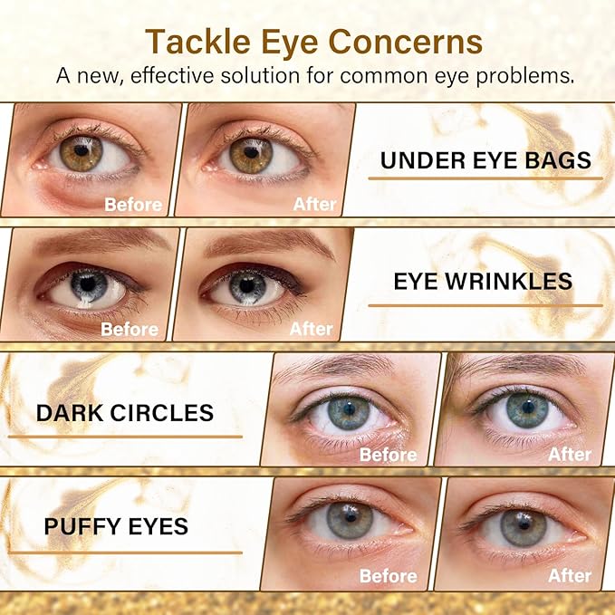 Gold Cucumber Under Eye Patches - 60 Pairs Hydrogel Eye Mask for Dark Circles & Wrinkles with Collagen, Hyaluronic Acid & Castor Oil, Hydrating & Smoothing Treatment - Gift Set for Men & Women