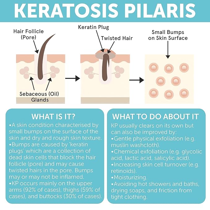 KP Bump Eraser Body Set with 10% AHA | Keratosis Pilaris Treatment | Keratosis Pilaris Lotion | Exfoliating Body Scrub | Ingrown Hair Treatment | Bundle Set for Bump, Strawberry Legs, Redness, Dryness