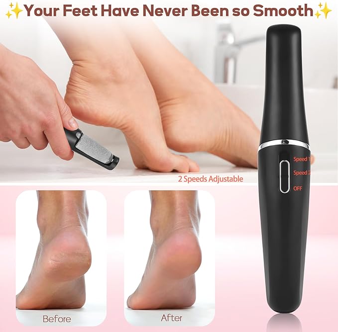 Electric Foot Callus Remover, Callus Remover for Feet Rechargeable Portable Pedicure Tool Kit, Smooth Pedicure Wand for Feet Care, Removes Dry Hard & Dead Skin Ideal Gift -Black