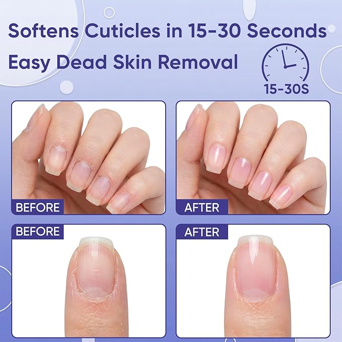 Cuticle Care Kit - Cuticle Remover Gel (1oz) & Ceramic Pusher with Nourishing Oil Pen (2ml). Complete At-Home Manicure & Pedicure Set for Dry & Damaged Nails. Salon Results (Gel+Pink Pen)