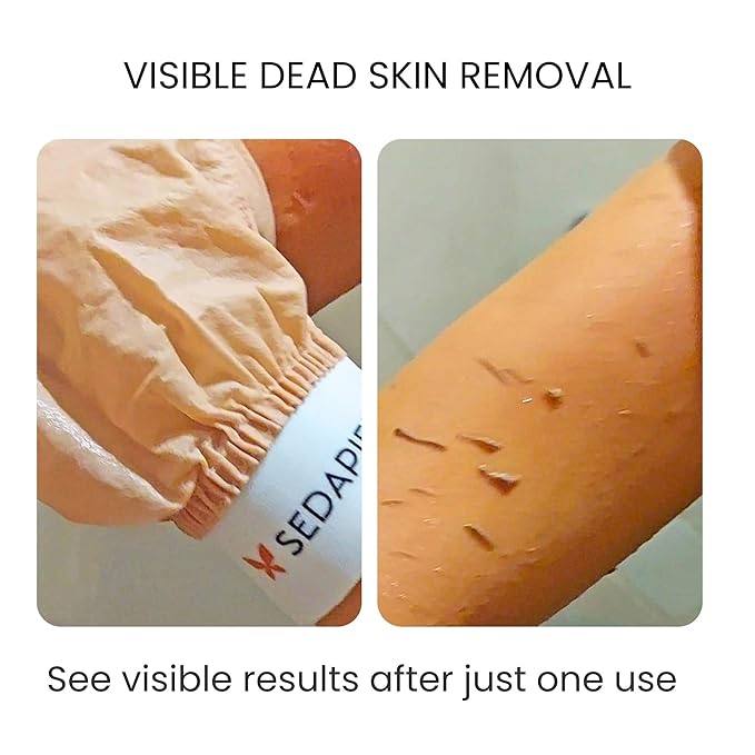 Turkish Silk Exfoliating Glove – Hammam Kese Mitt for Deep Dead Skin Removal – 100% Natural Cocoon Silk Body Scrub for Smooth, Radiant Skin – Reusable Spa Exfoliator by SEDAPIEL