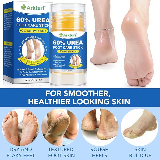 ABOUME 60% Urea Foot Care Stick with 2% Salicylic Acid, Urea Foot Cream for Dry Cracked Feet, Knees, Elbows, Avoid Frostbite, Heel Balm for Callus Remover & Dead Skin Softener (1PCS)