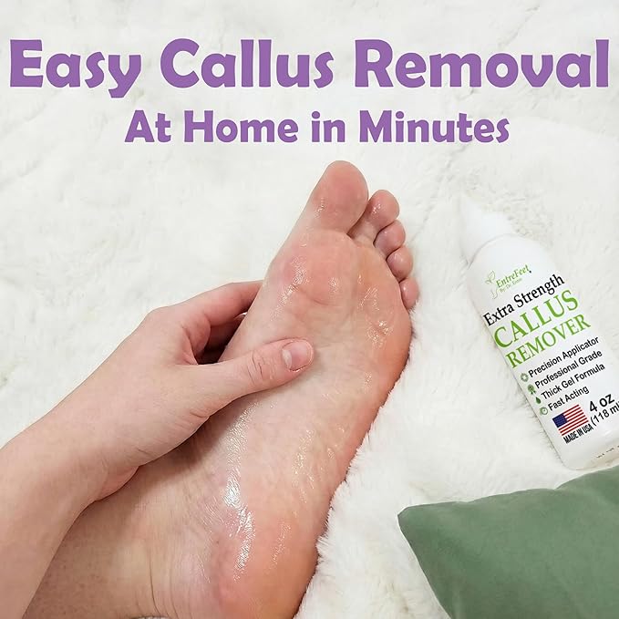 Dr. Entre's Callus Remover Gel: Extra Strength Callus Remover for Feet, Foot Callus Remover, Foot Care, Pedicure Tools Supplies, Dead Skin Remover, 4 oz