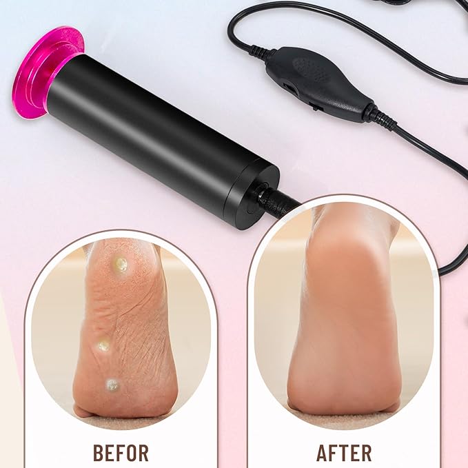 Dermawave Electric Foot File Callus Remover for Feet, Professional Electric Foot Sander Filer Grinder with 60 Sandpaper Discs for Men & Women, Pedicure Tool for Corn Dead Skin Cracked Heel