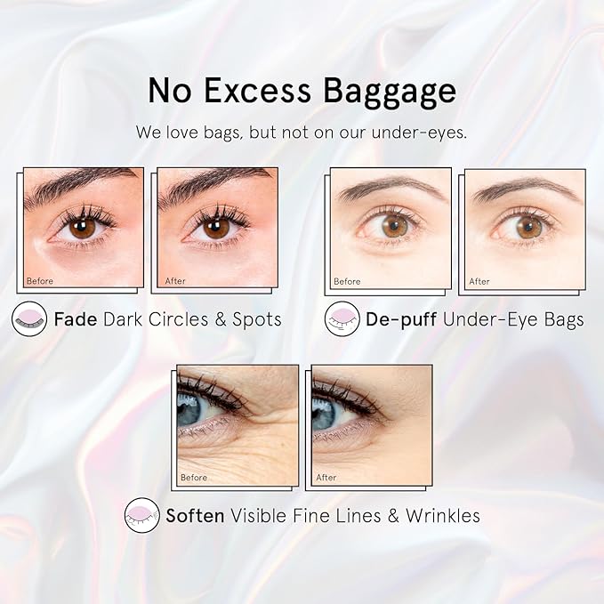 grace & stella Peptide Under Eye Patches with Niacinamide & Rice Extract - Firming Eye Masks for Dark Circles and Puffiness - Mothers Day Gift Bags - Vegan, Cruelty-Free (White, 24 Pairs)