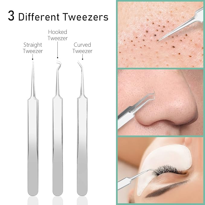 Pinkiou Blackhead Remover Comedone Pimple Popper Tool Acne Extractor Blemish Remover Ingrown Hair Tweezers Removal Kit Whitehead Remover Zit Treatment Skincare Tools for Face Nose,8 PCS
