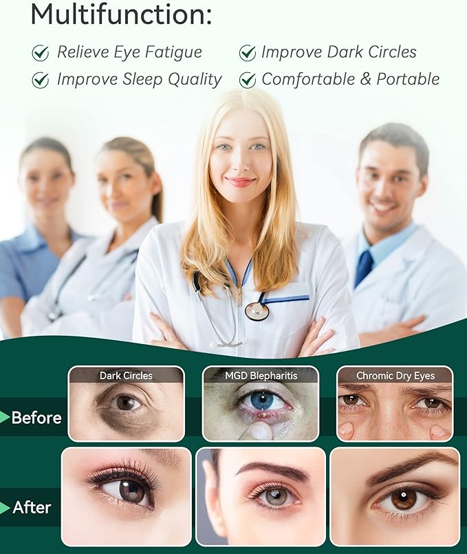 30PCS Steam Eye Masks for Dry Eyes & Fatigue Relief, Self-Heating Eye Mask for Puffiness & Dark Circles, Moist Heat Compress, Travel-Friendly, No Microwave Needed, Spa Relaxation for Women, Unscented
