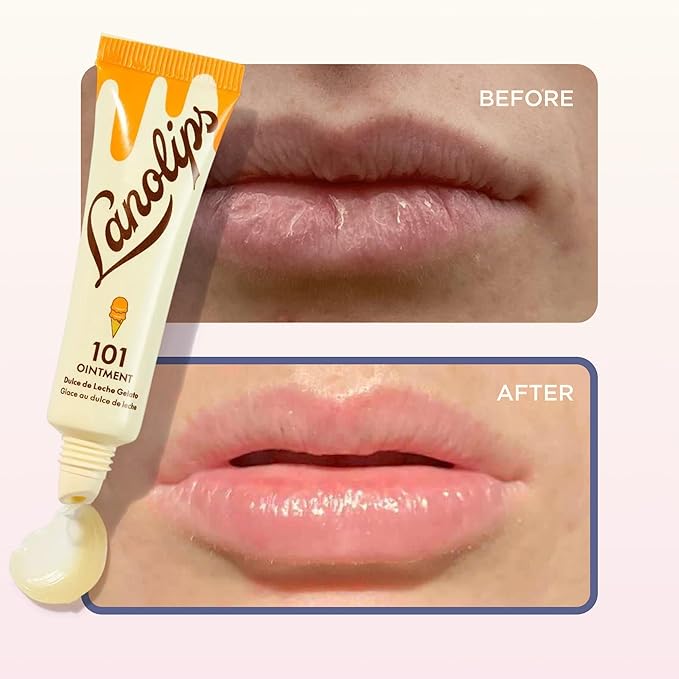 Lanolin 101 Multipurpose Ointment - Lanolin Lip Balm & Healing Ointment for Skin Barrier Repair - Moisturizer for Dry Lips, Cuticles & Elbows - No Petroleum Formula - Dulce de Leche (0.35 oz)