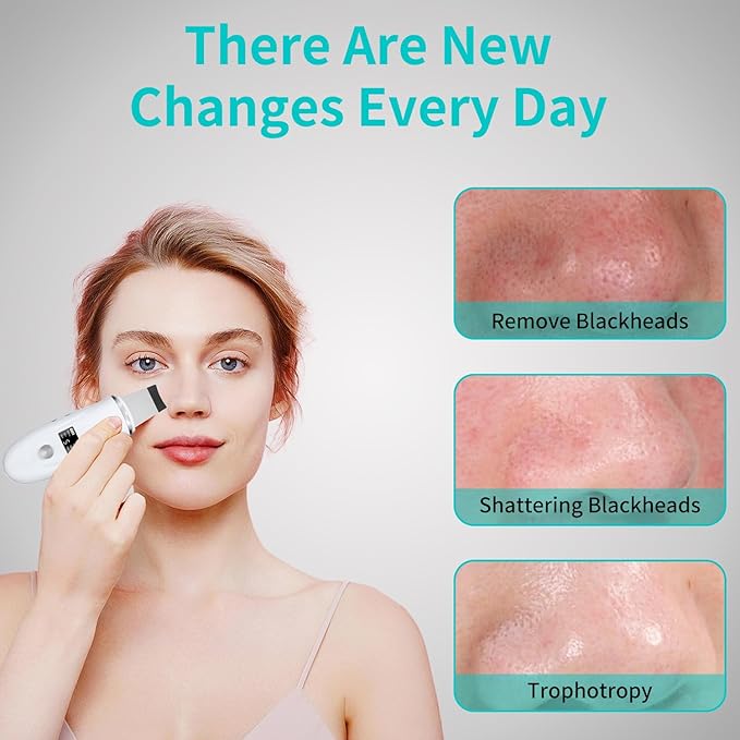 Face Spatula Blackhead Remover - 4 Modes Deep Cleansing Pore Extractor, Fast Charging Skin Scrubber for Women Facial Skincare Gift