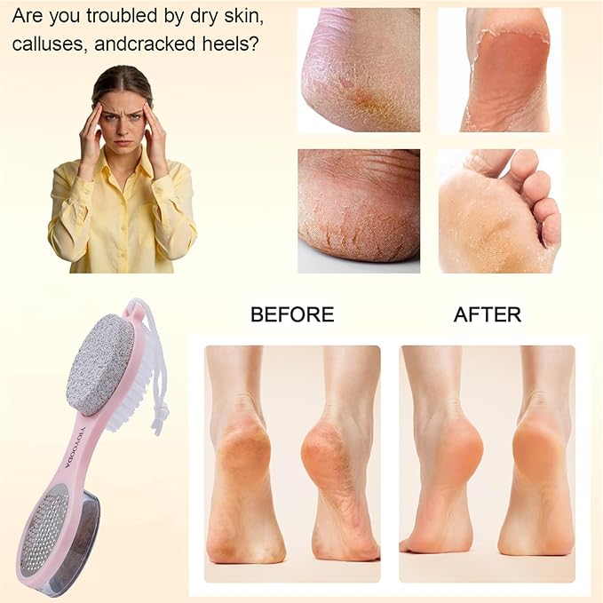 Foot File Callus Remover 5-in-1, 2 Pcs Feet Scraper Pedicure Tools with Pumice Stone, Scrubber Brush, Stainless Steel Foot Rasp and Sand Paper Debris Catcher, Multi Purpose, Pink