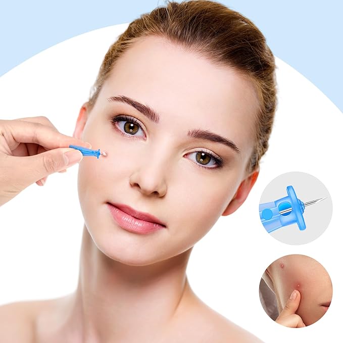 Lancets for Facial Extraction, 100Pcs Disposable Acne Lancet Effective Blemish and Blackhead Removal Tools for Clear Skin
