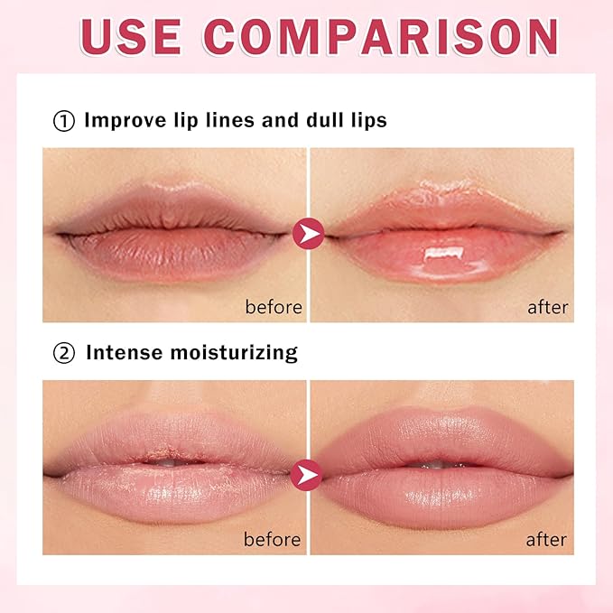 4PCS Honey Lip Balm Hydrating Honey Lip Mask Overnight Propolis Bee Lip Balm Prevention Dry and Cracked Lip Scrub Exfoliator (Honey+Strawberry+Coconut+Watermelon)