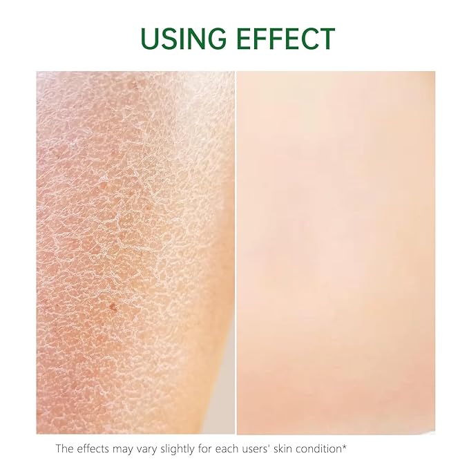 Collagen Lifting Body Oil After Shower, Hydrating Collagen Oil For Body, Moisturizing Anti Aging for Women & Men, Helps Soften Appearance of Crepey Skin for All Skin Types-1PC