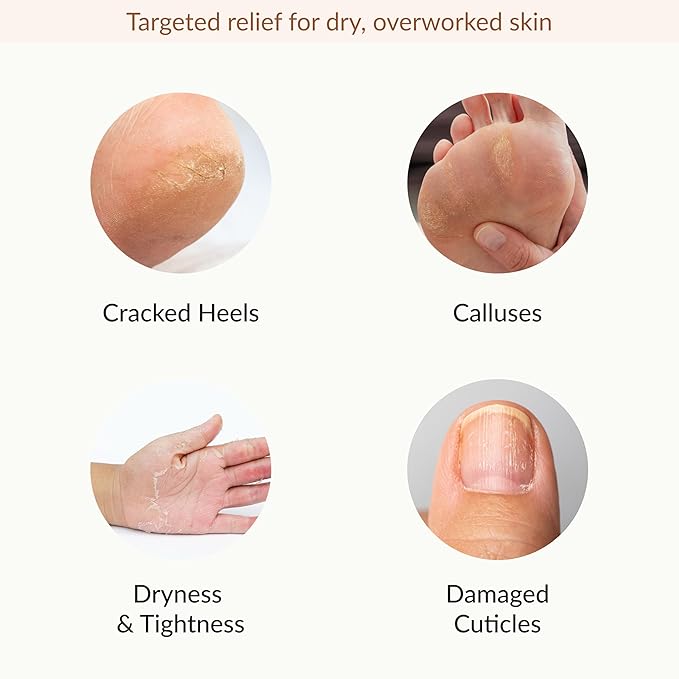 Epielle Hydrating & Moisturizing Hand & Foot Masks, Relieve and Soften Dry, Rough Skin, Self Care Gifts for Women, Spa Kit, Mothers Day Gifts, 6 Moisturizing Gloves & 6 Moisturizing Socks
