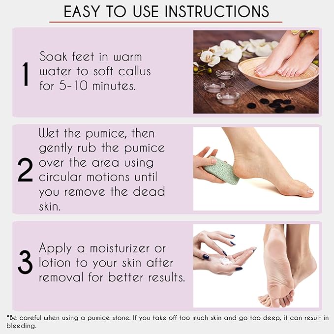 Karlash Professional Pedicure Foot Pumice Stone for Feet Skin Callus Remover and Scrubber for Dead Skins 2 Sided (Pack of 4)