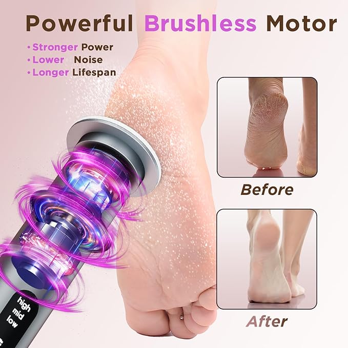 Electric Foot Callus Remover with Nano-Glass Head & 60Pcs Sandpaper Discs, 3 Hours Run Time, Electric Callus Remover for Feet with 3 Adjustable Speeds, Pedicure Tools for Dry Dead Skin Cracked Heels