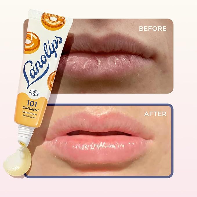 Lanolin 101 Multipurpose Ointment - Lanolin Lip Balm & Healing Ointment for Skin Barrier Repair - Moisturizer for Dry Lips, Cuticles & Elbows - No Petroleum Formula - Glazed Donut (0.35 oz)