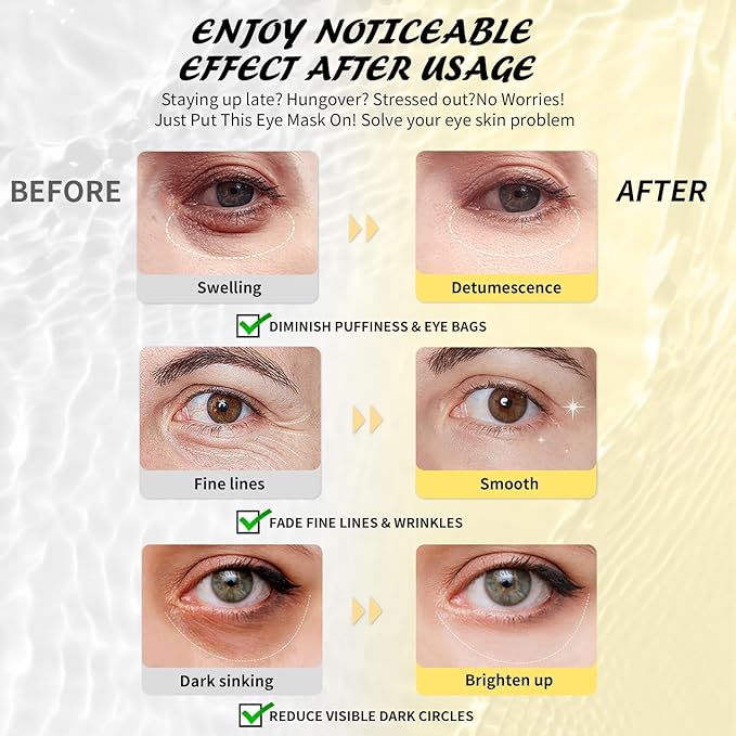 Maskiss Under Eye Patches(8 Pairs), 24K Gold, Caffeine, Hyaluronic Acid, Aloe Vera Eye Masks for Dark Circles Puffy Eyes Undereye Bags, Eye Skin Care Gift Set for Bachelorette Party Favors