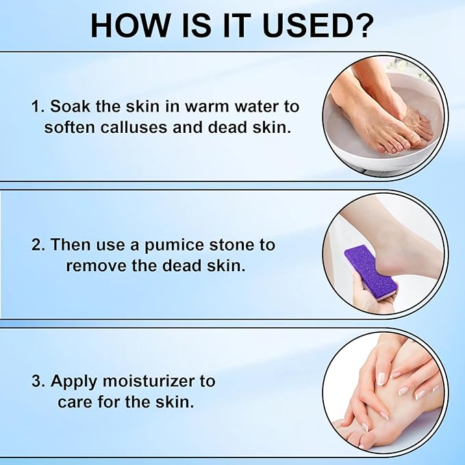 Foot Pumice Stone 4 Pack Pedicure Stone for Feet Pumice Sponge for Feet Callus Remover and Scrubber Double Sided Pedicure Foot Pumice Stone for Feet and Heels Callus and Dead Skins (Purple)
