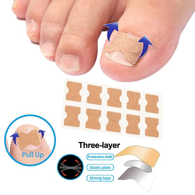 Ingrown Toenail Corrector Set with Correction Strips,Professional Ingrown Toenail Tool kit,Curved Toenails Corrector Patch,For Home Pedicure Care
