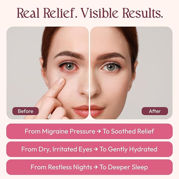FOMIN Steam Eye Mask for Mothers Day - 20 Pack - Rose & Jasmine - Self Heating Warm Compress for Dry Eyes, Heated Eye Mask for Sleep, Puffiness & Dark Circles Relief, Spa Relaxation Gifts for Mom