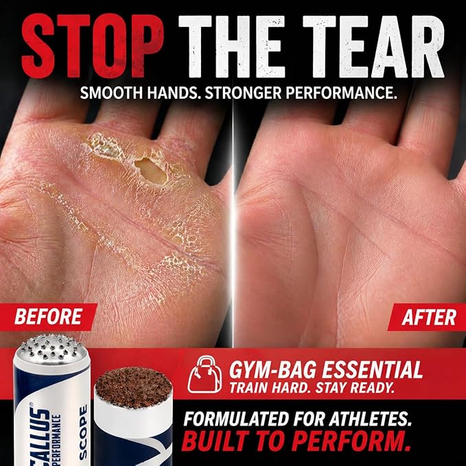 Score – Hand Callus Shaver & Smoothing File for Athletes & Working Hands | Prevent Rips & Tears | Precision Scraper for Weightlifting, Cross Fitness, Gymnastics & Rowing