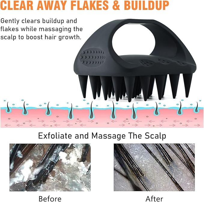 YEALIR Scalp Massager Shampoo Brush, Scalp Scrubber for Dandruff & Build Up, Scalp Massager Hair Growth - 100% Silicone, Plastic Free