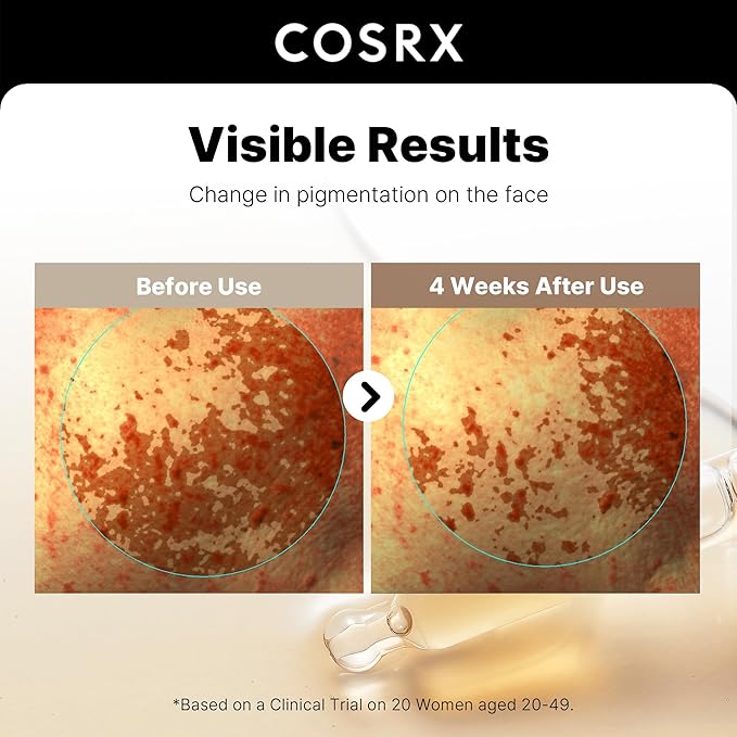 COSRX 2% Alpha Arbutin Discoloration Care Face Serum with Niacinamide, Glutathione & Tranexamic Acid, Dark Spot, Uneven Tone Care, Daily Korean Skin Care, Mothers Day Gifts for Woman, 1.7 fl oz