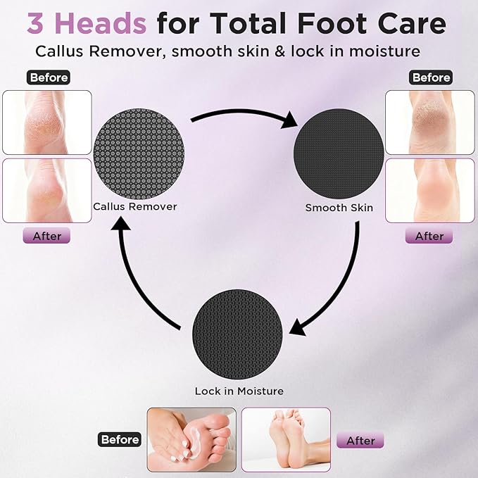 Electric Foot Callus Remover, Apply Oil,Foot SPA,Foot File,Reusable Nano-Glass Head, Ergonomic Premium Aluminum Callus Remover for feet, Rechargeable Pedicure Tools for Feet,Gifts for Men Women