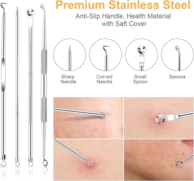 UUBAAR 9PCS Blackhead Remover Tools, Pimple Popper Tool Kit with 2 Tweezers, 304 Stainless Steel Comedone Extractor, 16 Precision Heads Face Nose Acne Zit Removal, Home Esthetician Use & Leather Case