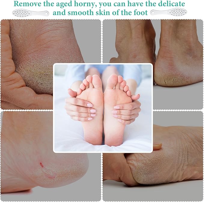 2 Pcs Stainless Steel Foot Scraper Metal Foot File Double Sided File Callus Remover Professional Feet Rasp Scrubber for Wet or Dry Skin Easy to Clean Pedicure Tool Heel (Combination Style)