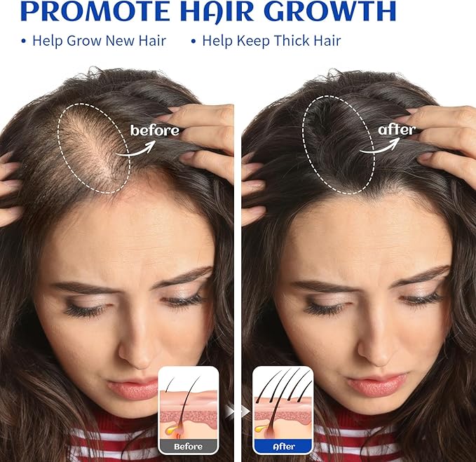 HIQILI Rosemary Oil for Hair Growth, Skin, Scalp, 100% Pure Natural, Add to Shampoo & Conditioner - 0.33 Fl Oz/10 ML
