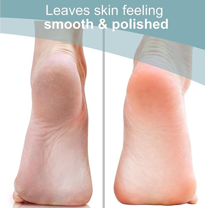 Trim Neat Feet Foot Care Implements Nano Glass Foot File, Hard Skin Remover for Feet, Manual Scraper, Callus Remover, Removes Dead Skin, Smooth Foot Health, Durable Pedicure Tool, Wet Or Dry, 1 Count