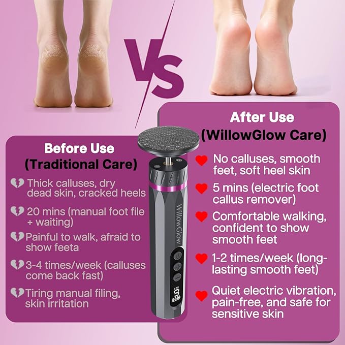 Professional Electric Foot Callus Remover, 9-Speed Cordless Foot File with Reusable Nano Glass Heads & Sandpaper for Dead Skin Removal and Smooth Feet