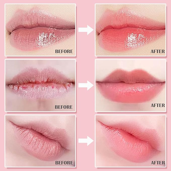 3PCS Bee Lip Balm Honey Pot, Lip Mask Skincare, Prevention Lip Dry Set, Strawberry, Watermelon, Honey Lip Sleeping Moisturizing Lip Balm, Mothers Day Gifts, Teacher Appreciation Gifts