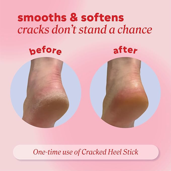 Onyx Professional Cracked Heel Repair Balm Stick, Lavender Scent, 1 Pack - Dry Heels Dry Cracked Feet Treatment, Moisturizing Heel Balm Rolls On, No Mess Like Foot Cream or Foot Lotion