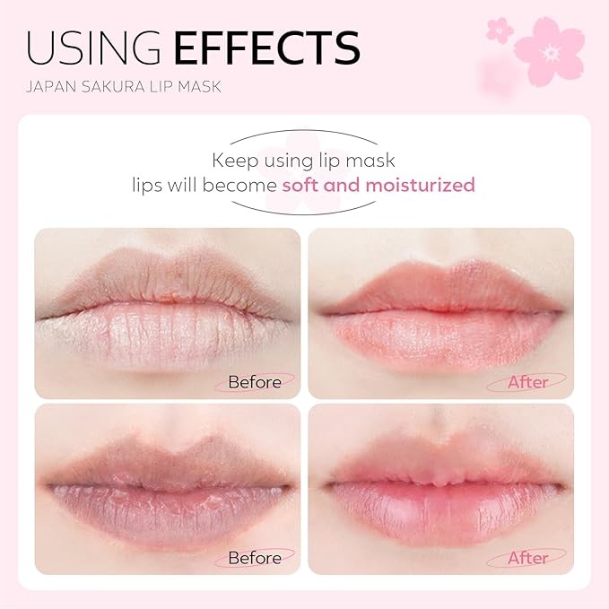 AKARY Sakura 5 Pieces Hydrating Lip Mask, Lip Sleep Mask Collagen Crystal Lip Care Gel Pads For Moisturizing, Minimize Fine Lines, Remove Dead Skin, Chapped Pads Lip Mask (5)