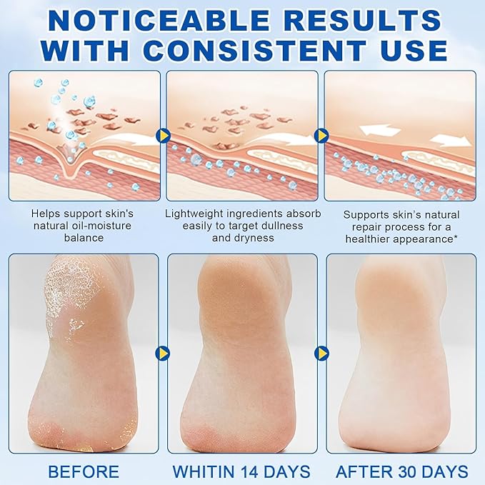 60% Urea Stick with 2% Salicylic Acid, Maximum Strength Callus Remover & Cracked Heel Repair Balm, Non-Greasy Foot Moisturizer for Dry Skin, 1.41 Oz (1pcs)
