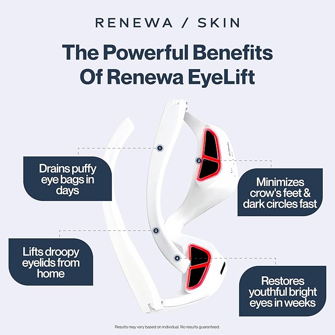 Renewa EyeLift | Under-Eye Beauty Tool with Gentle Light | Skincare Tool for Refreshing, Brightening and Radiant-Looking Skin | At-Home Self-Care Facial Tool for Smoother-Looking Eyes